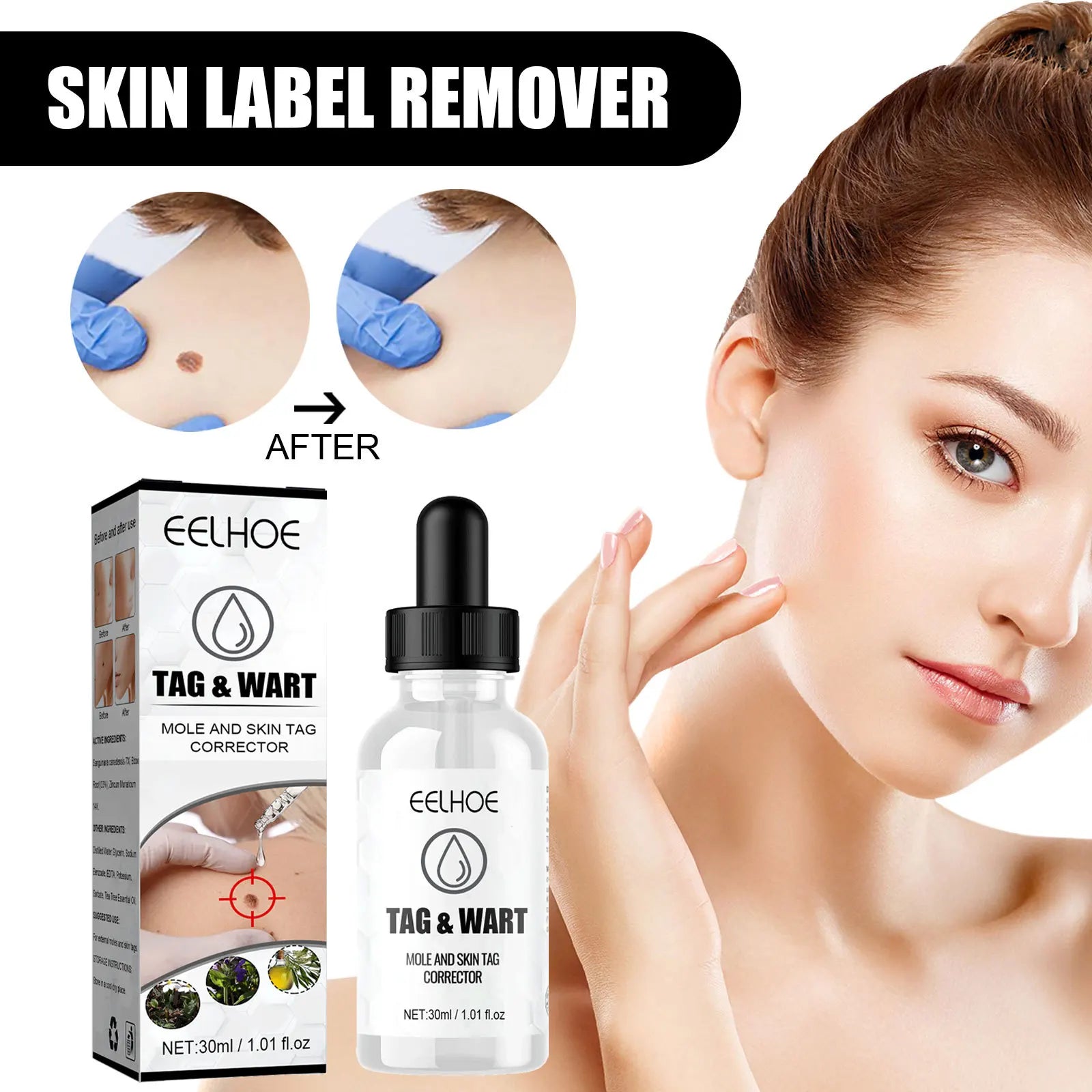 Eelhoe Skin Care Serum Effective Mole and Wart Remover Flesh Mole Plana Repair
